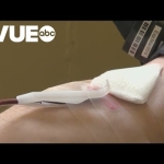 Austin authorities launch blood draw program for DWIs